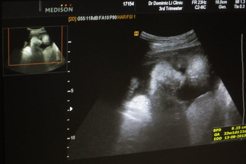 baby3