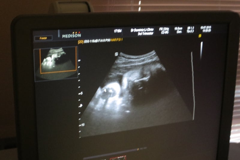 Baby2