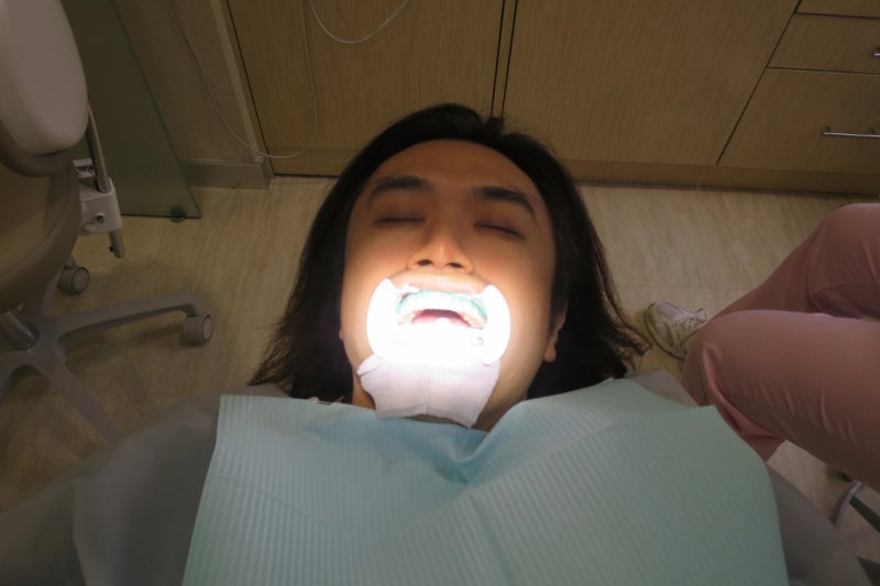 Whitening3